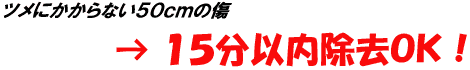 ツメにかからない5長さ0cmの傷→15分以内除去OK!