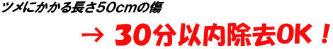 ツメにかかる長さ50cmの傷→30分以内除去OK!